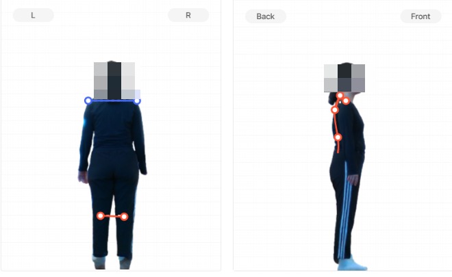 운동 후 근육통이 며칠씩 간다면 — 일자허리일 때 생기는 일