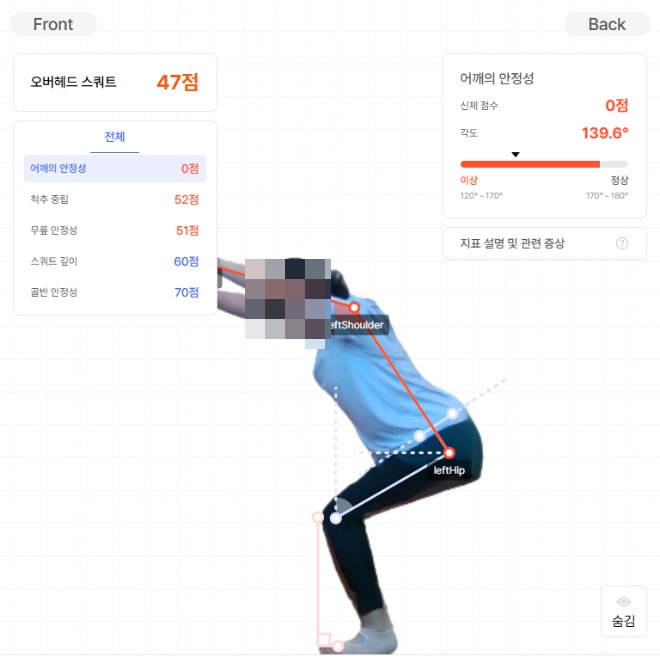 동탄 임상노트 | 수술 직전까지 갔다가 — 회전근개 파열, 운동으로 돌아온 이야기