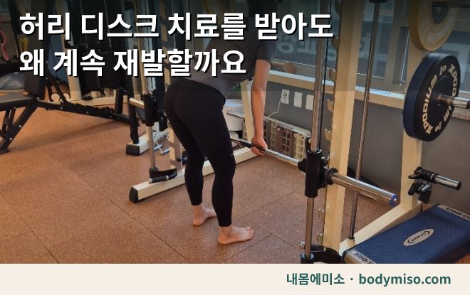 허리디스크 재발 — 치료를 받아도 반복되는 이유
