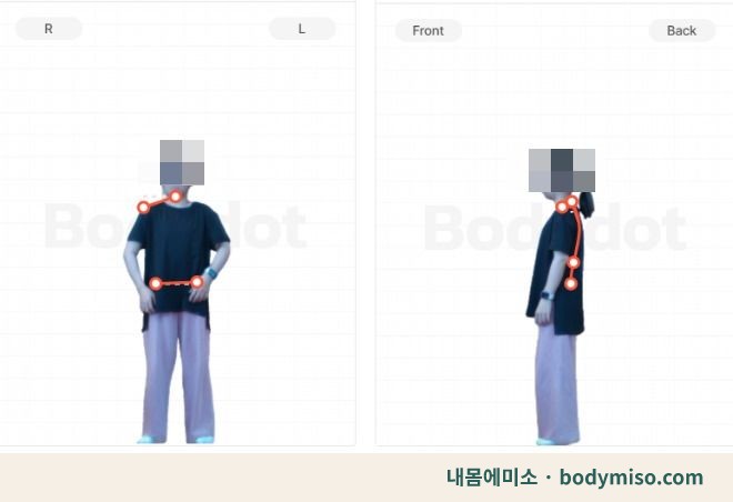 동탄 거북목·굽은등 체형측정 — 정면·후면 결과 화면