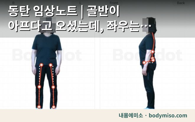 동탄 임상노트 | 골반이 아프다고 오셨는데, 좌우는 거의 완벽하게 맞아 있었어요