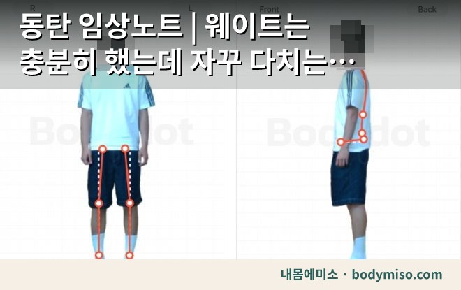 힘은 센데 자꾸 다친다면 — 웨이트로는 안 채워지는 것