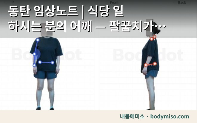 동탄 임상노트 | 식당 일 하시는 분의 어깨 — 팔꿈치가 끝까지 안 펴지고 있었어요