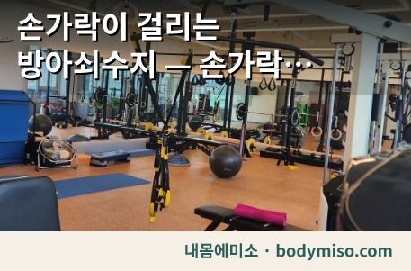 방아쇠수지 — 손가락 말고 손목과 팔꿈치부터 봅니다