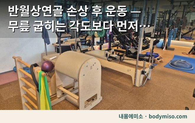 반월상연골 손상 후 운동 — 무릎 굽히는 각도보다 먼저 보는 것
