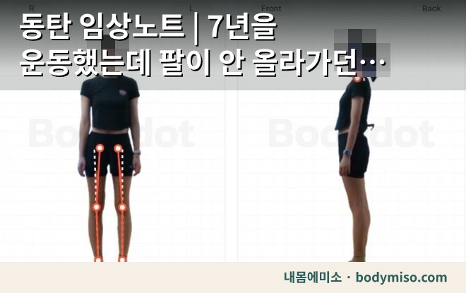 동탄 임상노트 | 7년을 운동했는데 팔이 안 올라가던 분 — 이번엔 끝까지 가보기로 했습니다