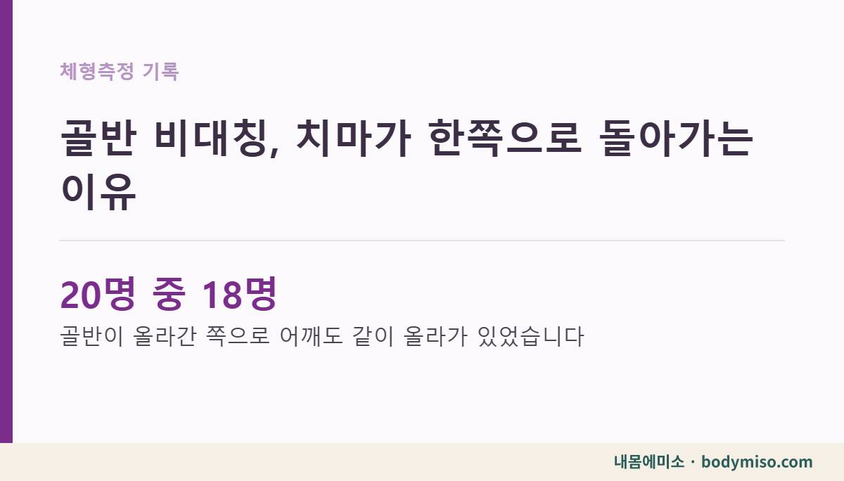 골반 비대칭, 치마가 한쪽으로 돌아가는 이유