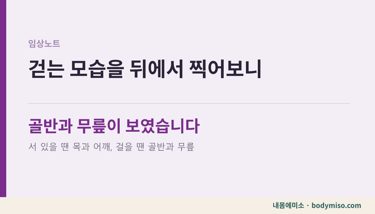 걸을 때 골반 흔들림과 안으로 모이는 무릎